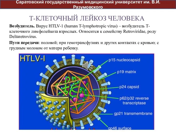 Т-КЛЕТОЧНЫЙ ЛЕЙКОЗ ЧЕЛОВЕКА Возбудитель. Вирус HTLV-1 (human T-lymphotropic virus) – возбудитель