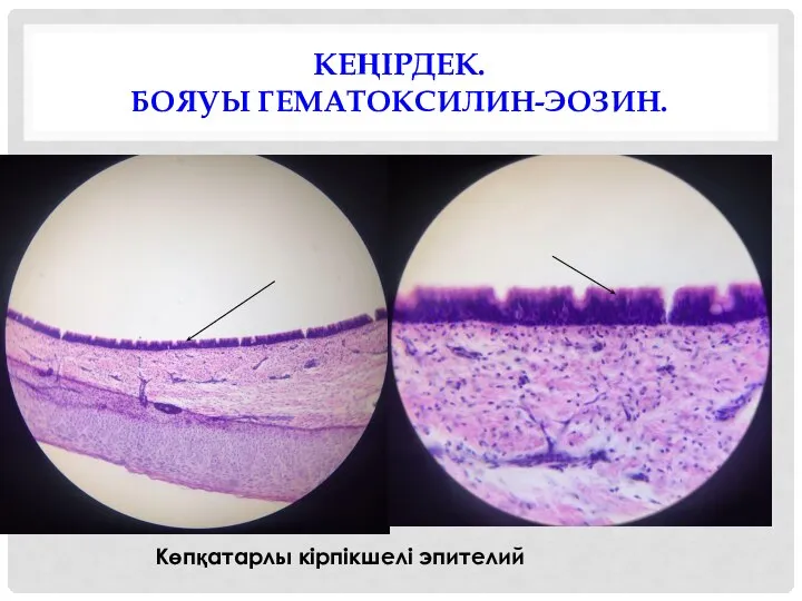 КЕҢІРДЕК. БОЯУЫ ГЕМАТОКСИЛИН-ЭОЗИН. Көпқатарлы кірпікшелі эпителий