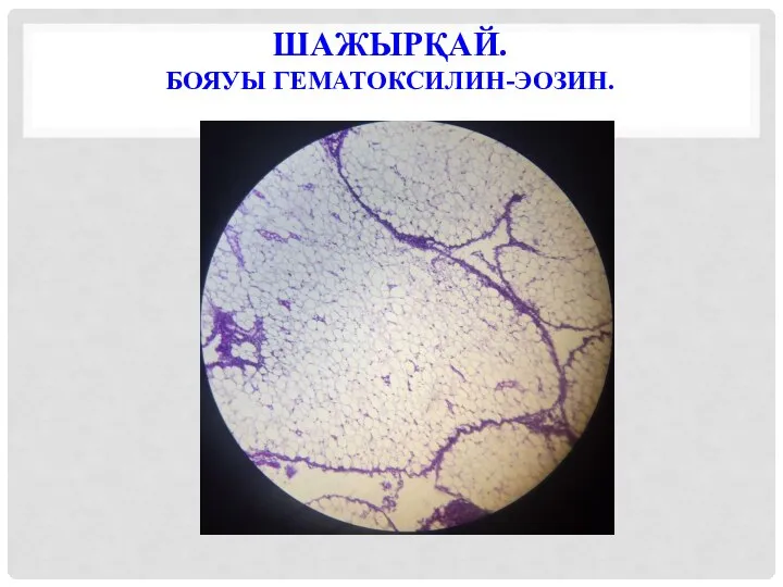 ШАЖЫРҚАЙ. БОЯУЫ ГЕМАТОКСИЛИН-ЭОЗИН.