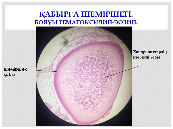 ҚАБЫРҒА ШЕМІРШЕГІ. БОЯУЫ ГЕМАТОКСИЛИН-ЭОЗИН. Хондроциттердің изогенді тобы Шеміршек қабы