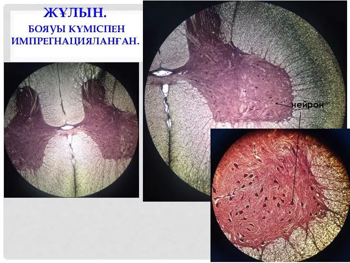 ЖҰЛЫН. БОЯУЫ КҮМІСПЕН ИМПРЕГНАЦИЯЛАНҒАН. нейрон