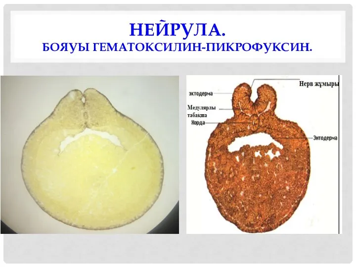 НЕЙРУЛА. БОЯУЫ ГЕМАТОКСИЛИН-ПИКРОФУКСИН.