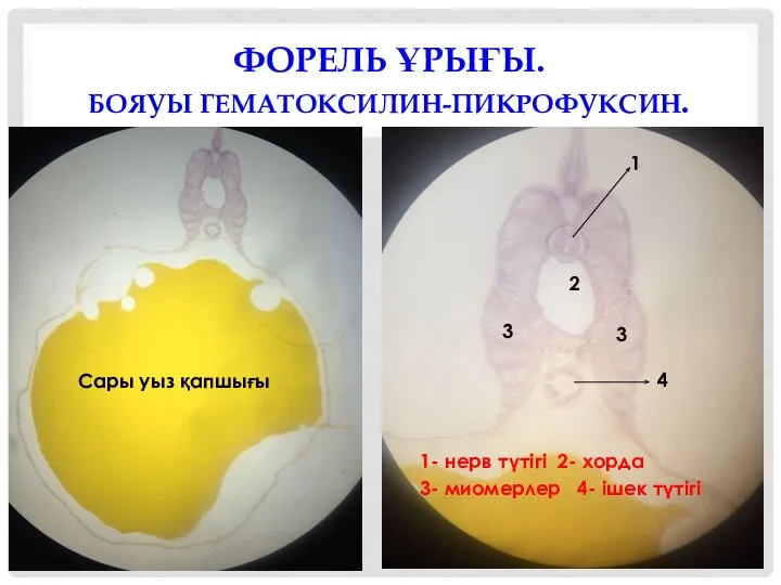 ФОРЕЛЬ ҰРЫҒЫ. БОЯУЫ ГЕМАТОКСИЛИН-ПИКРОФУКСИН. Сары уыз қапшығы 1 2 3 3