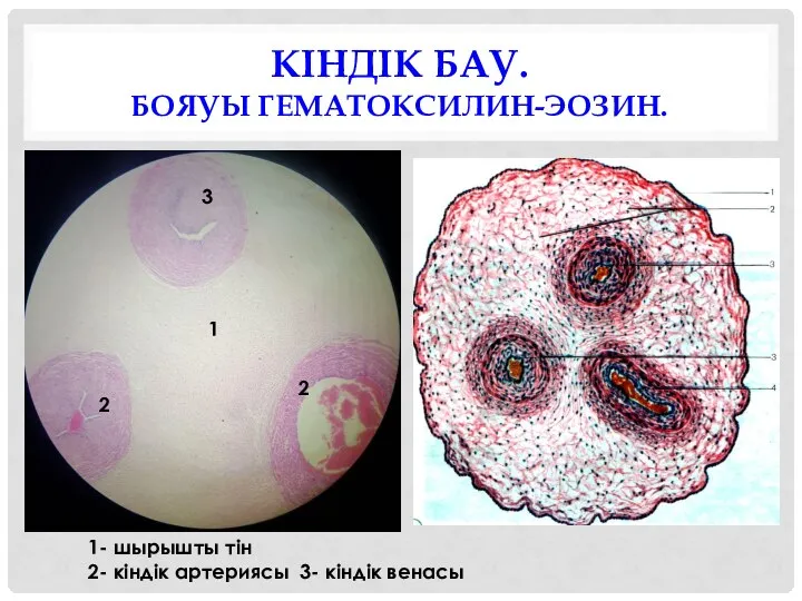 КІНДІК БАУ. БОЯУЫ ГЕМАТОКСИЛИН-ЭОЗИН. 1- шырышты тін 2- кіндік артериясы 3-