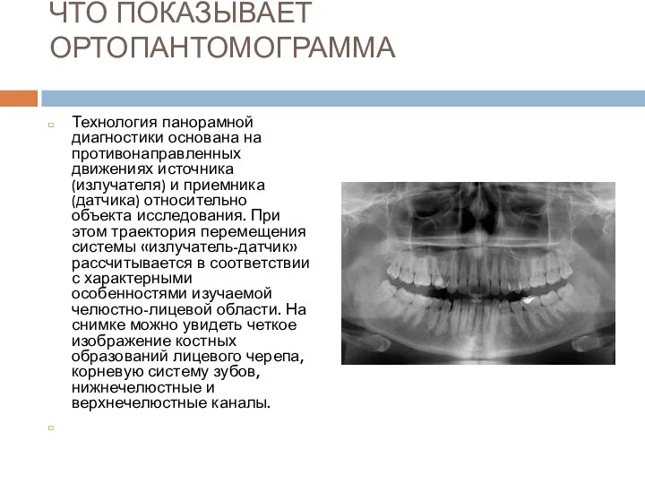 ЧТО ПОКАЗЫВАЕТ ОРТОПАНТОМОГРАММА Технология панорамной диагностики основана на противонаправленных движениях источника
