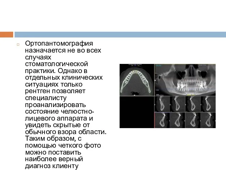 Ортопантомография назначается не во всех случаях стоматологической практики. Однако в отдельных