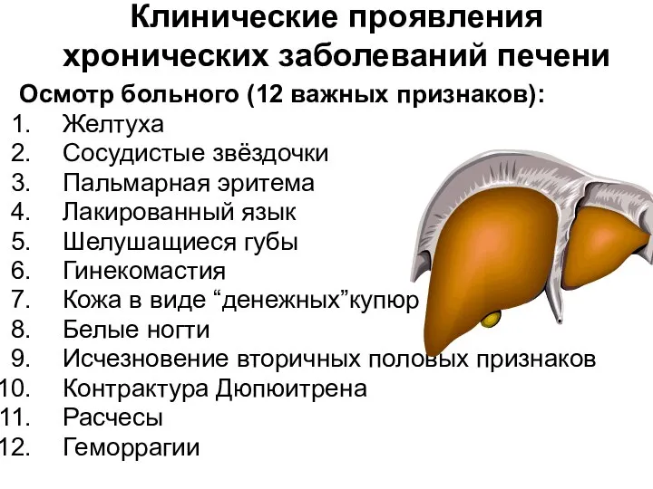 Клинические проявления хронических заболеваний печени Осмотр больного (12 важных признаков): Желтуха