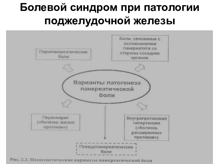 Болевой синдром при патологии поджелудочной железы