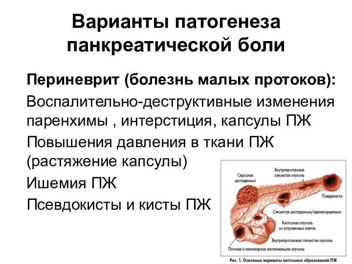 Варианты патогенеза панкреатической боли Периневрит (болезнь малых протоков): Воспалительно-деструктивные изменения паренхимы