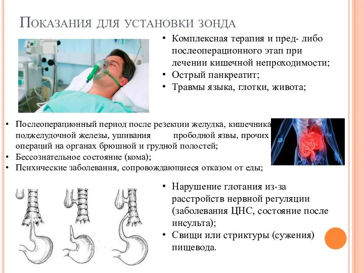 Показания для установки зонда Комплексная терапия и пред- либо послеоперационного этап