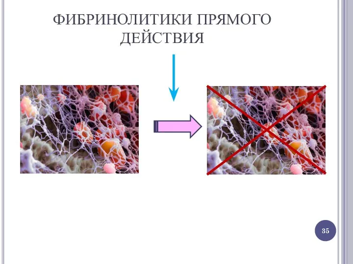 ФИБРИНОЛИТИКИ ПРЯМОГО ДЕЙСТВИЯ