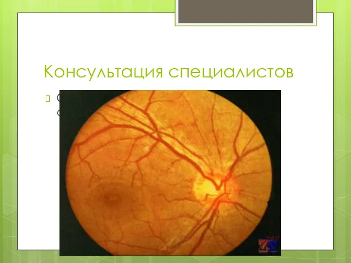 Консультация специалистов Окулист- ОИ- Ангиосклероз сосудов сетчатки II.