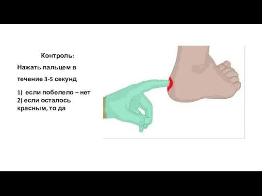 Контроль: Нажать пальцем в течение 3-5 секунд 1) если побелело –