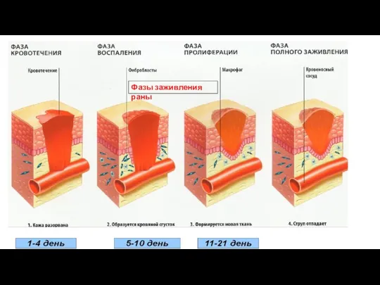 Фазы заживления раны