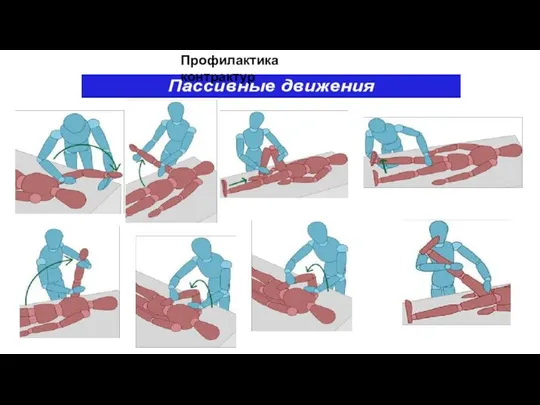 Профилактика контрактур