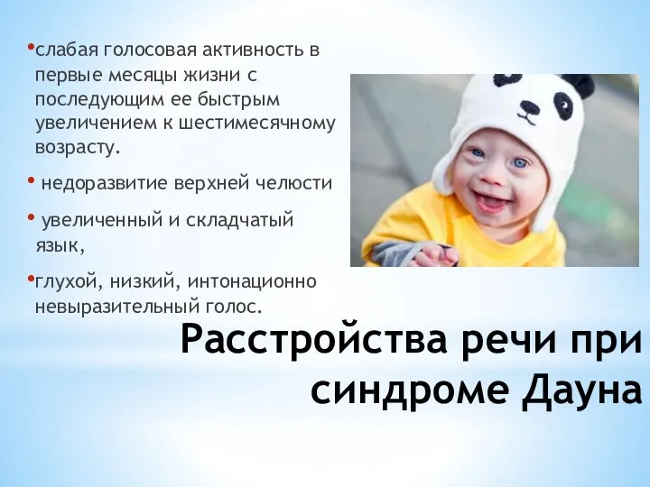 Расстройства речи при синдроме Дауна слабая голосовая активность в первые месяцы