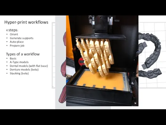 Hyper-print workflows Types of a workflow Basic A-Type models Dental models