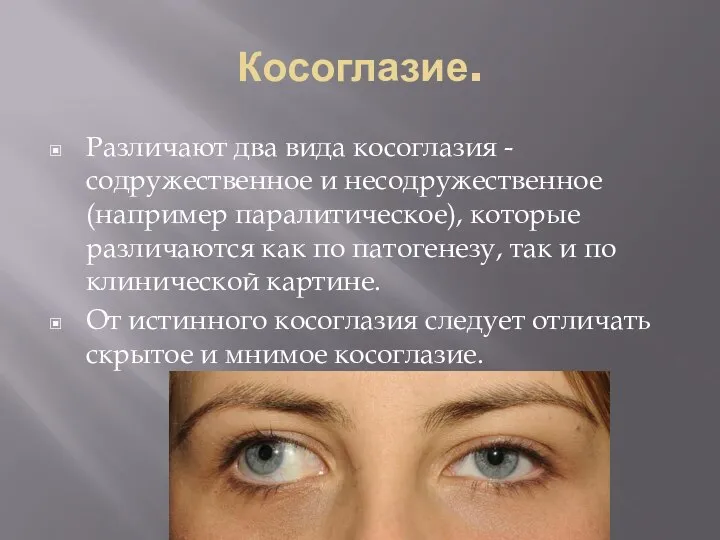 Косоглазие. Различают два вида косоглазия - содружественное и несодружественное (например паралитическое),