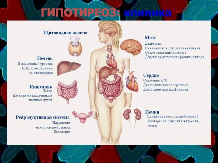 ГИПОТИРЕОЗ: клиника