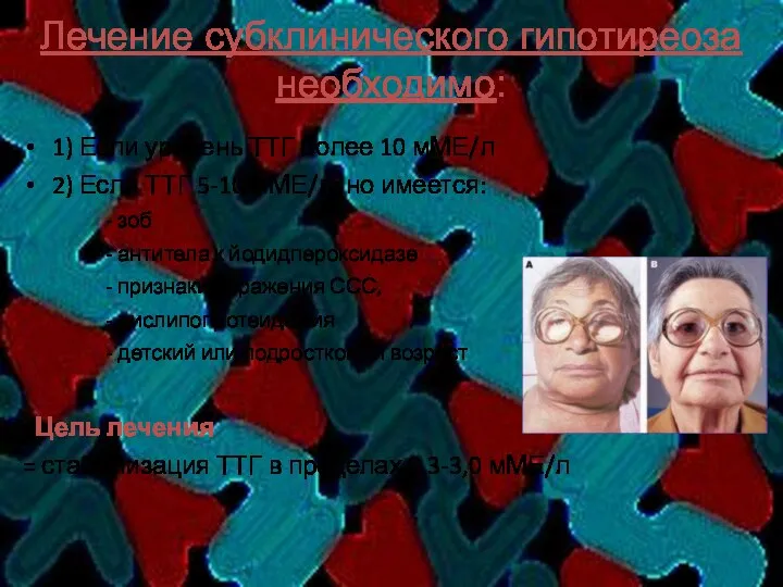 Лечение субклинического гипотиреоза необходимо: 1) Если уровень ТТГ более 10 мМЕ/л