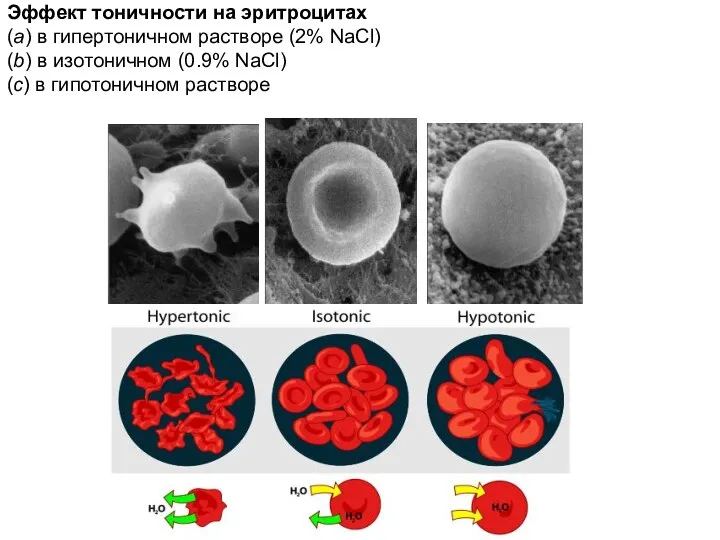 Эффект тоничности на эритроцитах (a) в гипертоничном растворе (2% NaCl) (b)