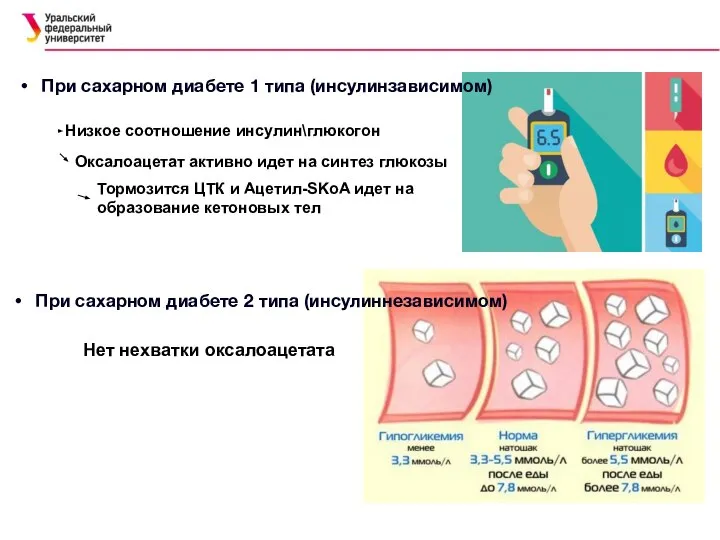 При сахарном диабете 1 типа (инсулинзависимом) При сахарном диабете 2 типа