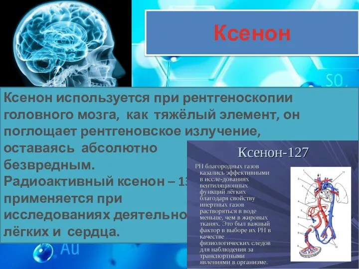Ксенон Ксенон используется при рентгеноскопии головного мозга, как тяжёлый элемент, он