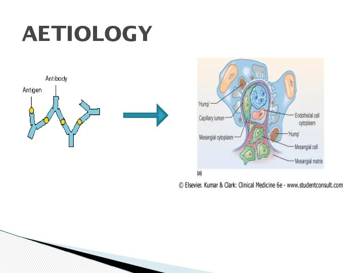 AETIOLOGY