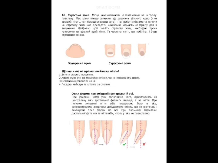 16. Стресова зона. Місце максимального навантаження на нігтьову пластину. Має різну