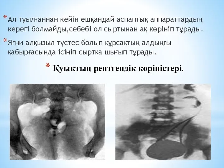 Ал туылғаннан кейін ешқандай аспаптық аппараттардың керегі болмайды,себебі ол сыртынан ақ