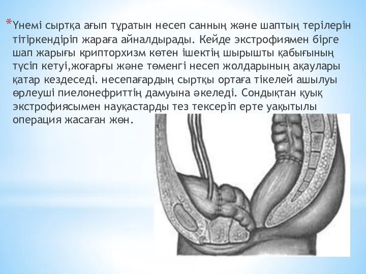 Үнемі сыртқа ағып тұратын несеп санның және шаптың терілерін тітіркендіріп жараға