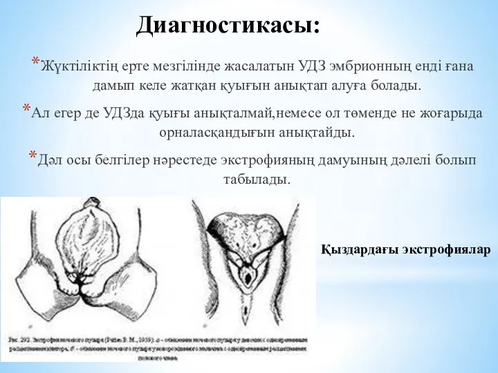 Диагностикасы: Жүктіліктің ерте мезгілінде жасалатын УДЗ эмбрионның енді ғана дамып келе