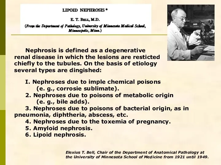 Nephrosis is defined as a degenerative renal disease in which the