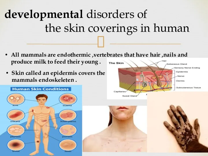 developmental disorders of the skin coverings in human All mammals are