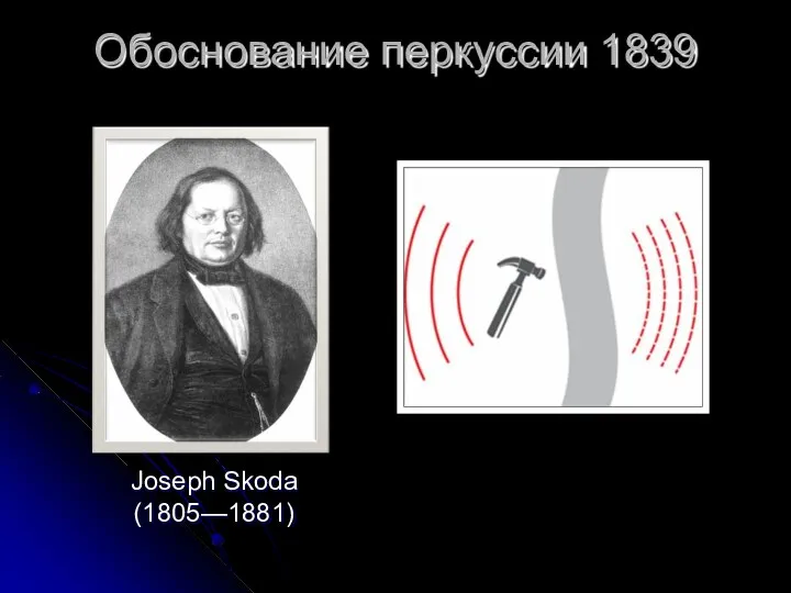 Обоснование перкуссии 1839 Joseph Skoda (1805—1881)