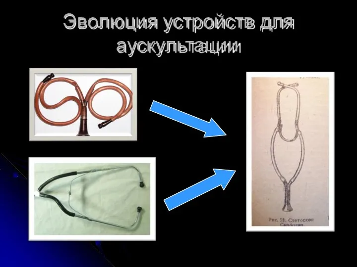 Эволюция устройств для аускультации