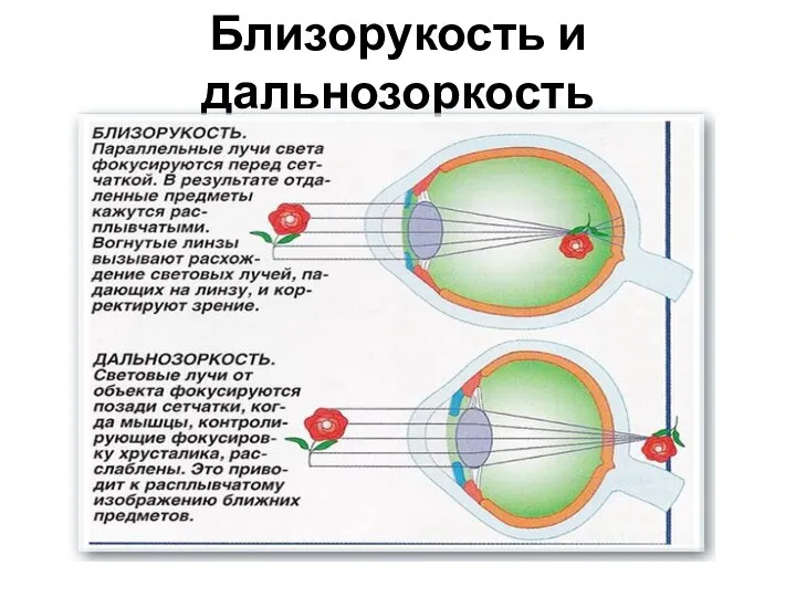 Близорукость и дальнозоркость