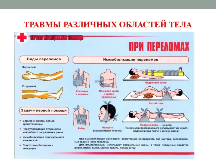 ТРАВМЫ РАЗЛИЧНЫХ ОБЛАСТЕЙ ТЕЛА