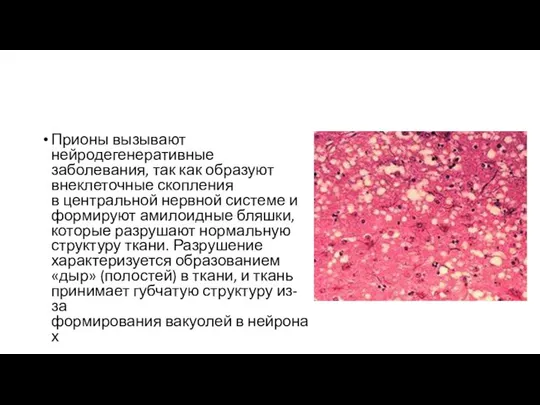 Прионы вызывают нейродегенеративные заболевания, так как образуют внеклеточные скопления в центральной