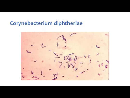 Corynebacterium diphtheriae