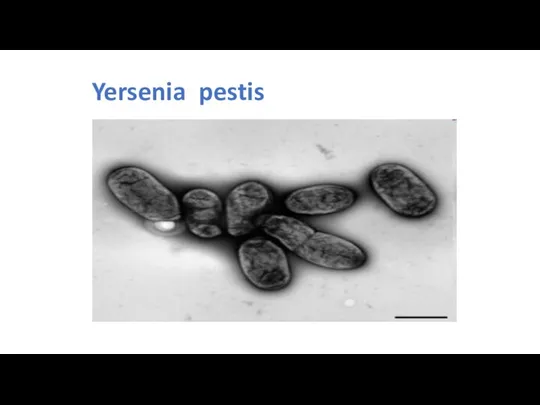 Yersenia pestis