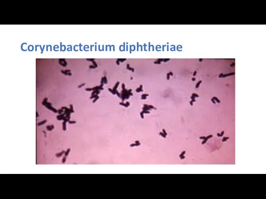 Corynebacterium diphtheriae