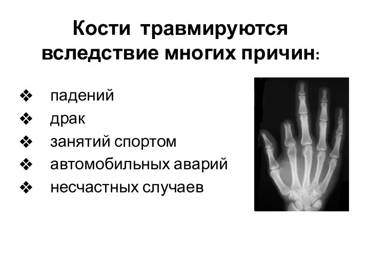 Кости травмируются вследствие многих причин: падений драк занятий спортом автомобильных аварий несчастных случаев