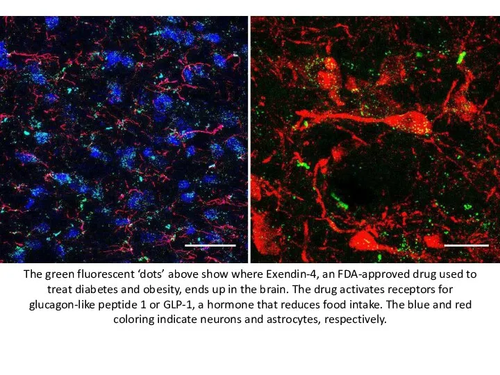 The green fluorescent ‘dots’ above show where Exendin-4, an FDA-approved drug