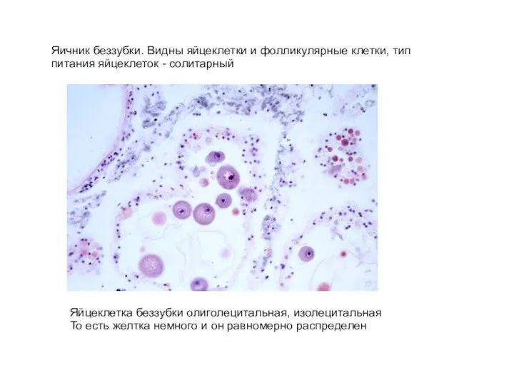 Яичник беззубки. Видны яйцеклетки и фолликулярные клетки, тип питания яйцеклеток -