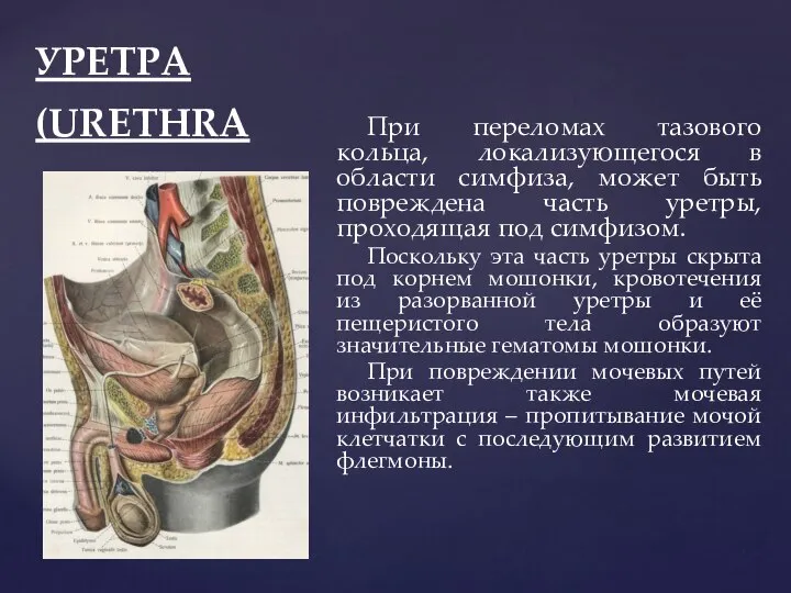 УРЕТРА (URETHRA При переломах тазового кольца, локализующегося в области симфиза, может