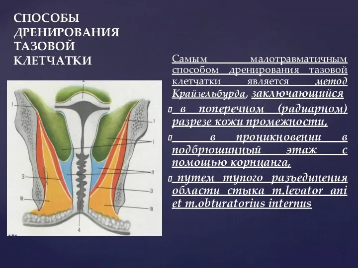 СПОСОБЫ ДРЕНИРОВАНИЯ ТАЗОВОЙ КЛЕТЧАТКИ Самым малотравматичным способом дренирования тазовой клетчатки является