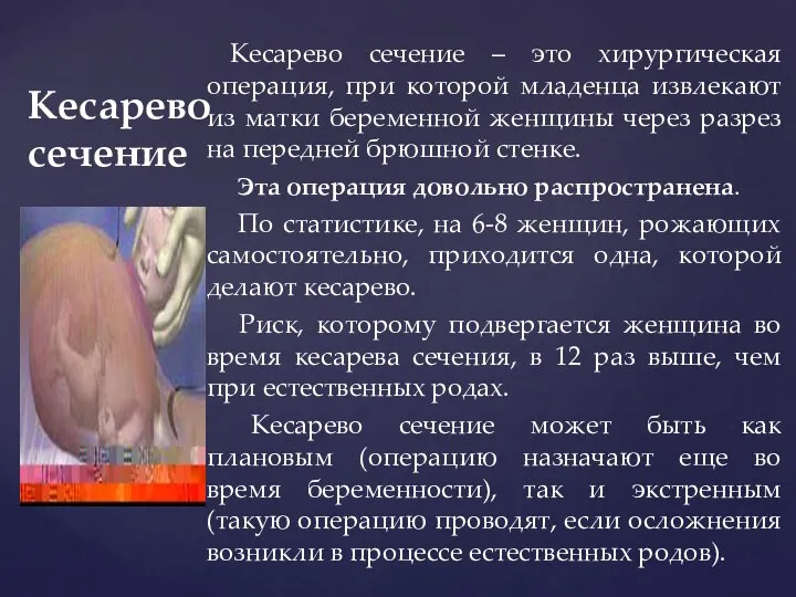 Кесарево сечение Кесарево сечение – это хирургическая операция, при которой младенца