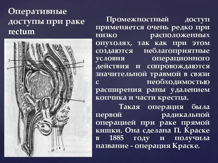 Оперативные доступы при раке rectum Промежностный доступ применяется очень редко при