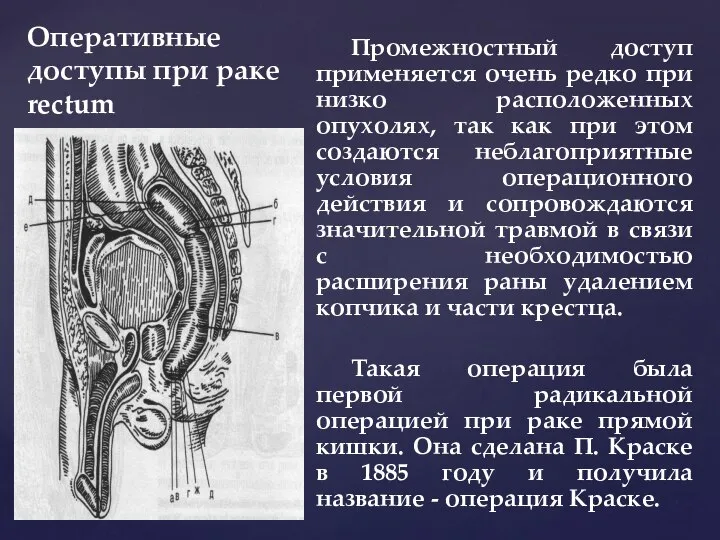 Оперативные доступы при раке rectum Промежностный доступ применяется очень редко при